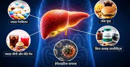 सिर्फ शराब नहीं! ये 5 रोजमर्रा की आदतें भी बना सकती हैं लिवर को बीमार, एक्सपर्ट्स चेतावनी